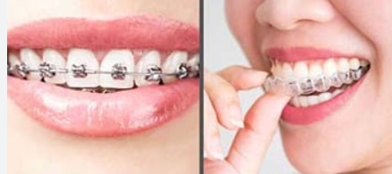 Dentist in Trivandrum – Dr. Kashi Vishwanath